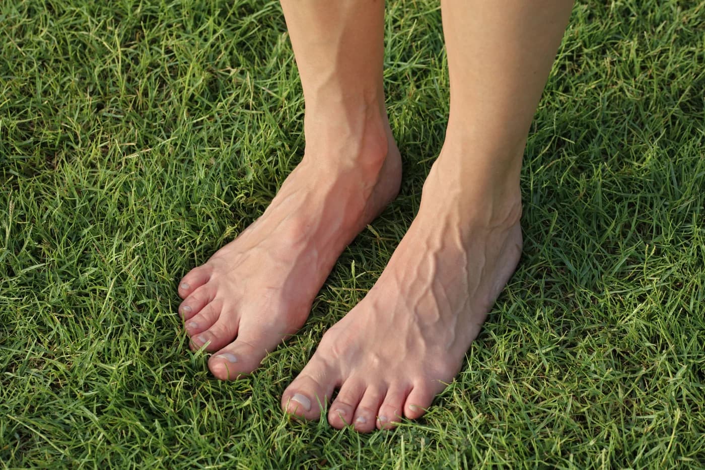 Both bare feet standing on grass, seen from above, with raised veins running across the top of each foot and up toward the ankles