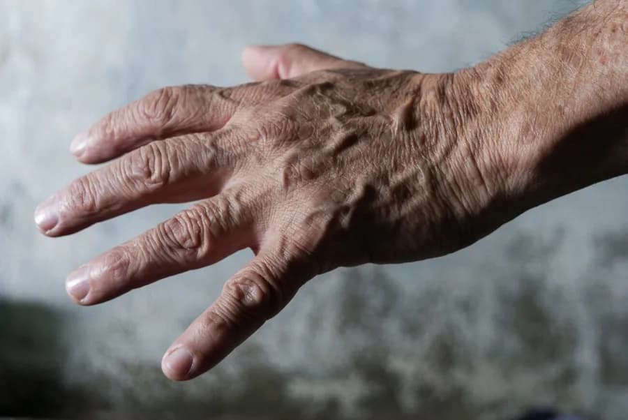 The back of an older adult's outstretched hand, with prominent raised veins across it