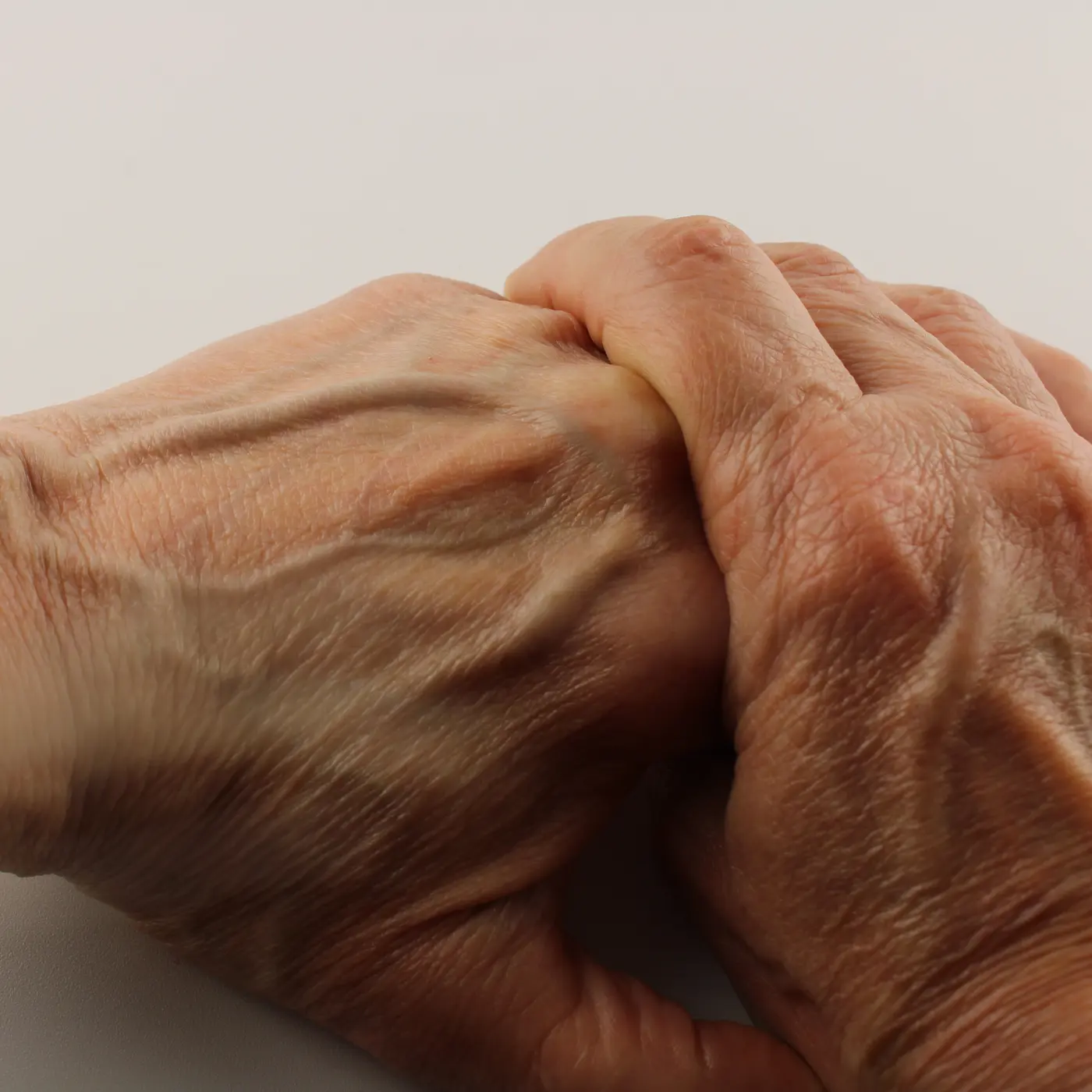 Two hands clasped together against a pale background, with raised veins running across the back of the upper hand