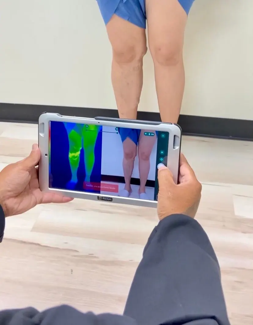 A clinician holds a thermal imaging tablet showing a heat map of a patient's legs beside a matching photo, while the patient stands behind it.