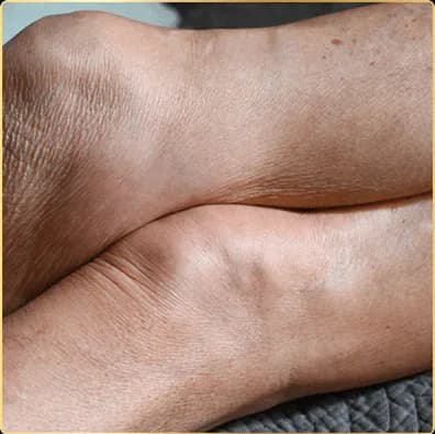 Close-up of two crossed bare ankles, the skin finely creased and papery, on gray fabric