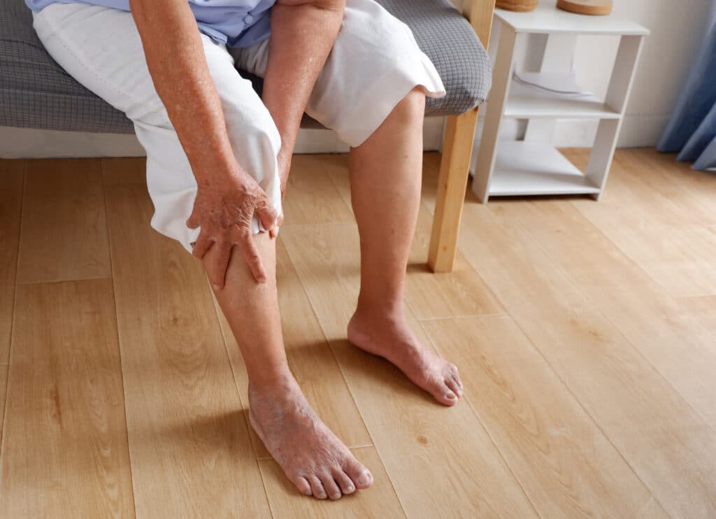 Close up of a patient with a sedentary lifestyle clutching their leg in pain from varicose veins